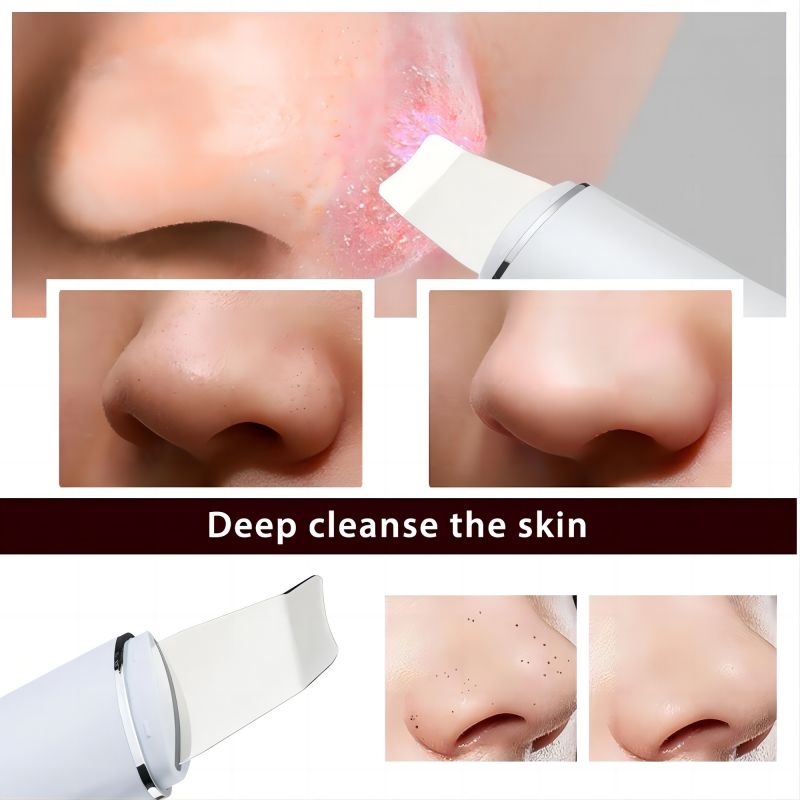 Ultrasonic Skin Scrubber Vibration Face Spatula Blackhead Remover Shovel Deep Clean Pore Device Facial Peeling Skin Care Tool