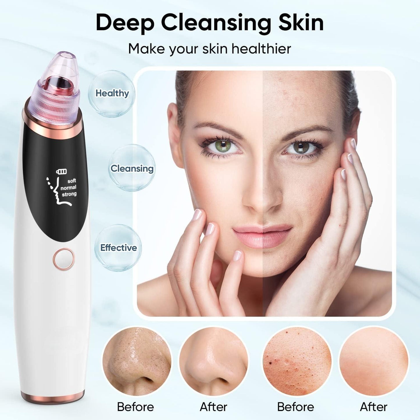 Electric Blackhead Remover Pore Vacuum Facial Acne Cleaner Black Spot Removal Whitehead Extractor Skin Care Tool for Face Nose