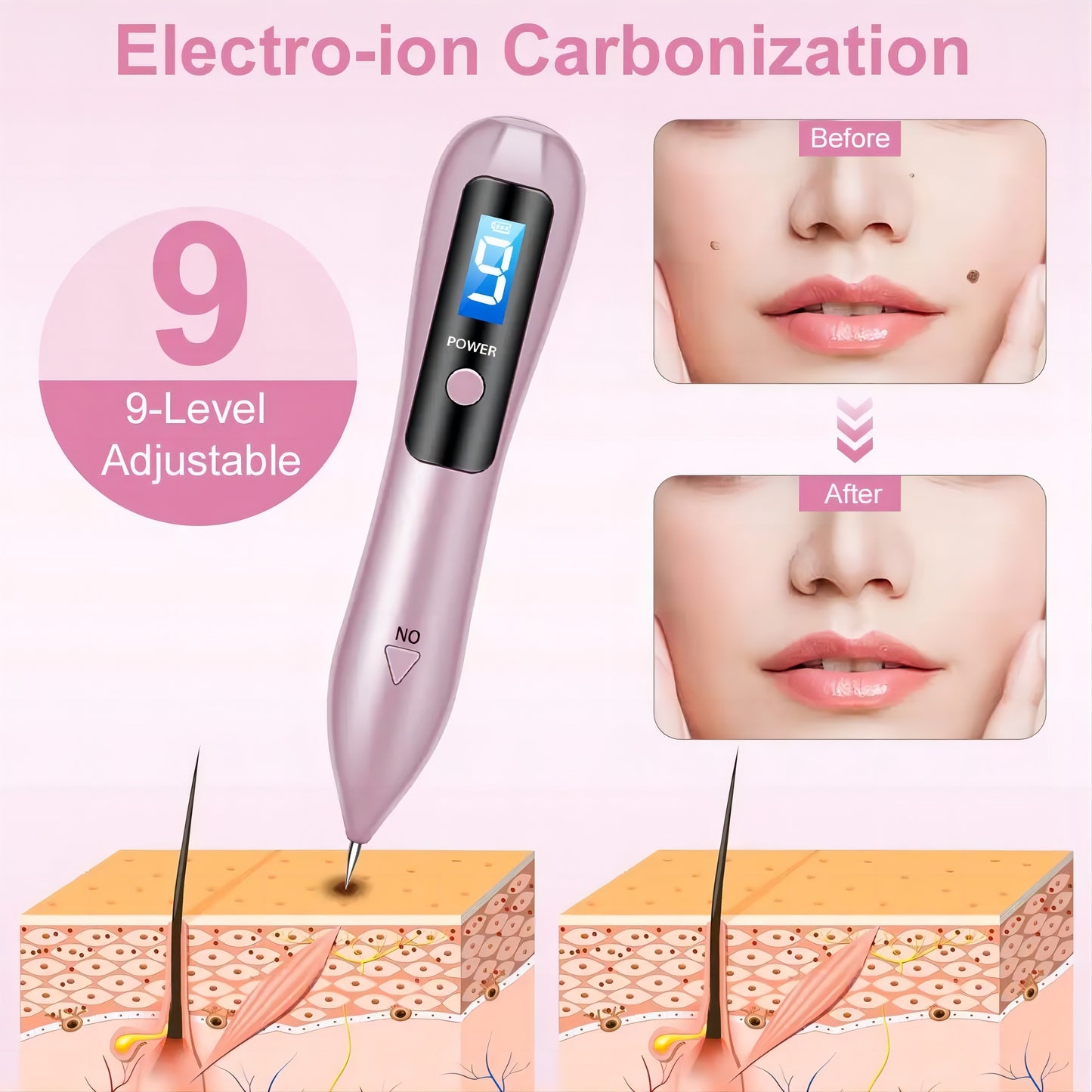 LCD Laser Plasma Pen Mole Warts Tattoo Freckle Removal Sweep Dark Spot Skin Tag Remover Facial Care Electric Beauty Device